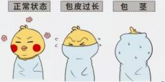 包皮過長會引起包皮炎嗎？”